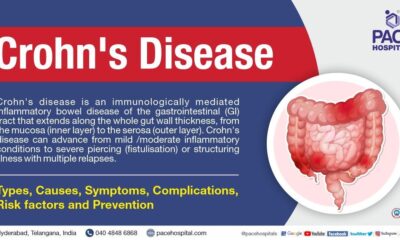 Crohn bmj criteria