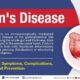 Crohn bmj criteria
