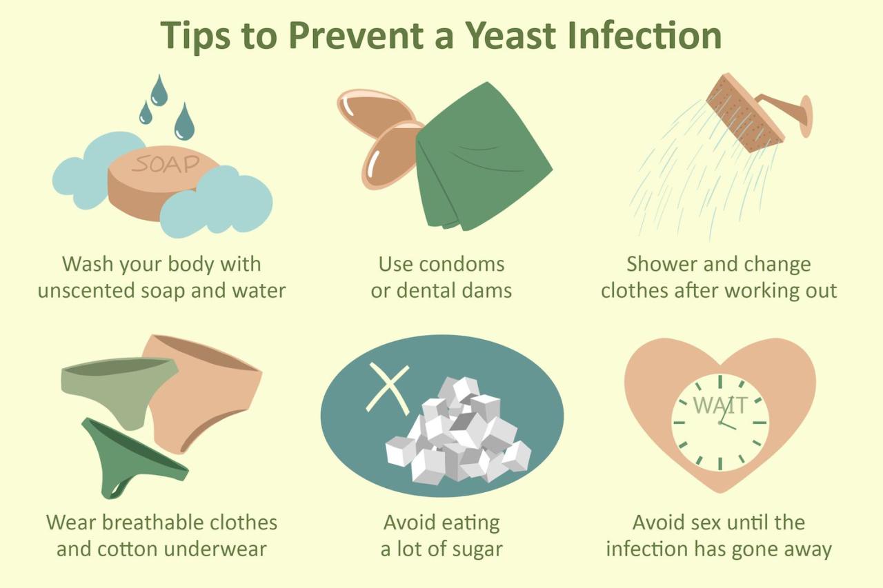 Yeast infection infographic Yeast infection infographic